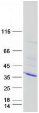 Coomassie blue staining of purified CDK2 protein.